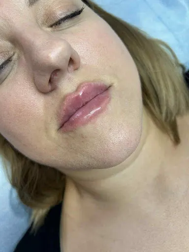 New Derm Magdalena Chilewska